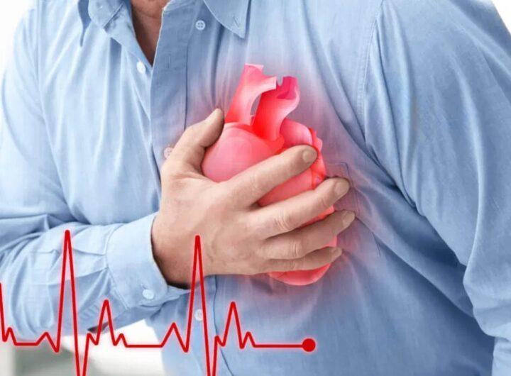 Heart Attack